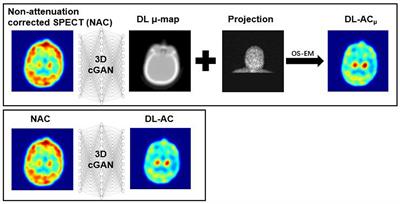 Generative adversarial network-based attenuation correction for 99mTc-TRODAT-1 brain SPECT